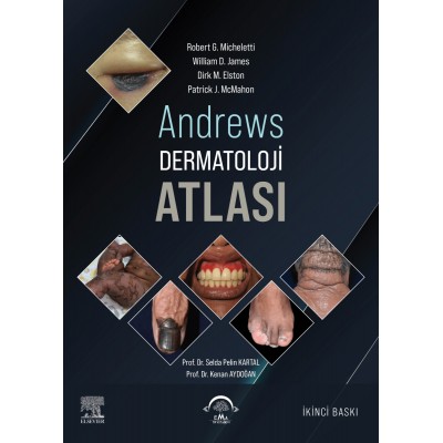 Andrews Dermatoloji Atlası