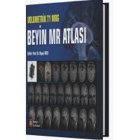 Volumetrik T1 MRG Beyin MR Atlası