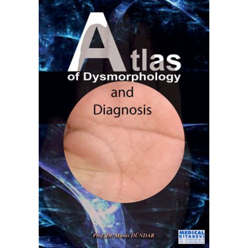 Atlas of Dysmorphology and Diagnosis
