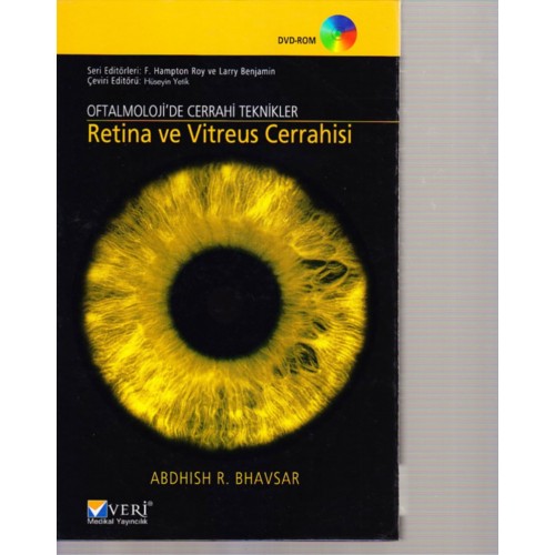 Oftalmolojide Cerrahi Teknikler Retina ve Vitreus Cerrahisi