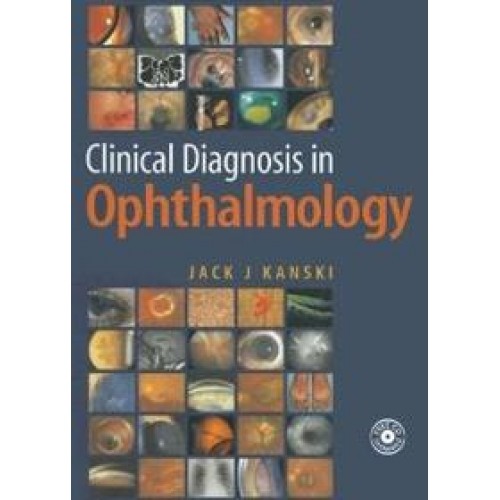 Clinical Diagnosis in Ophtalmology ( Türkçe ) CD İlaveli