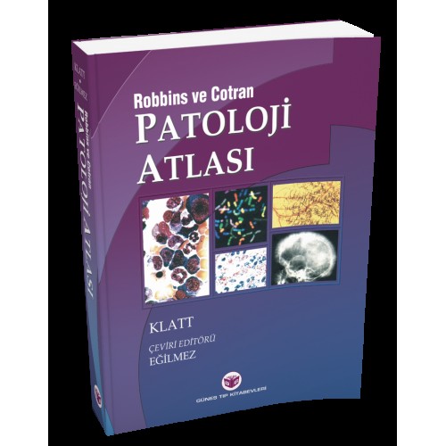 Robbins Patoloji Atlası