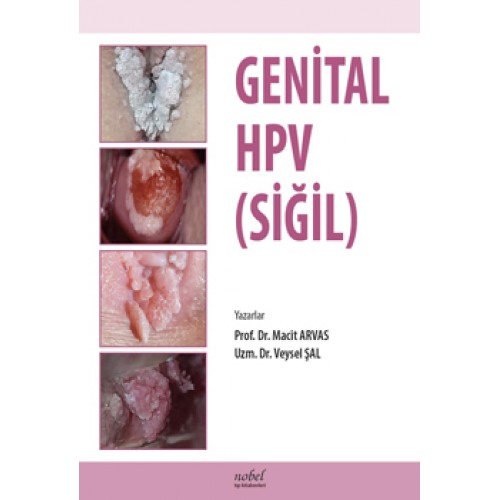 Genital HPV (SİĞİL)