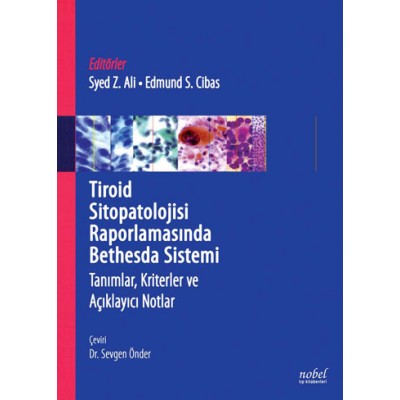 Tiroid Sitopatolojisi Raporlamasında Bethesda Sistemi: Tanımlar, Kriterler ve Açıklayıcı Notlar