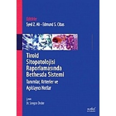 Tiroid Sitopatolojisi Raporlamasında Bethesda Sistemi Tanımlar, Kriterler ve Açıklayıcı Notlar