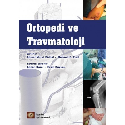 Ortopedi ve Travmatoloji