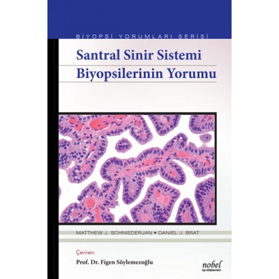 Santral Sinir Sistemi Biyopsilerinin Yorumu - Biyopsi Yorumları Serisi