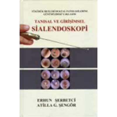 Tanısal ve Girişimsel Sialendoskopi Tanısal ve Girişimsel Sialendoskopi
