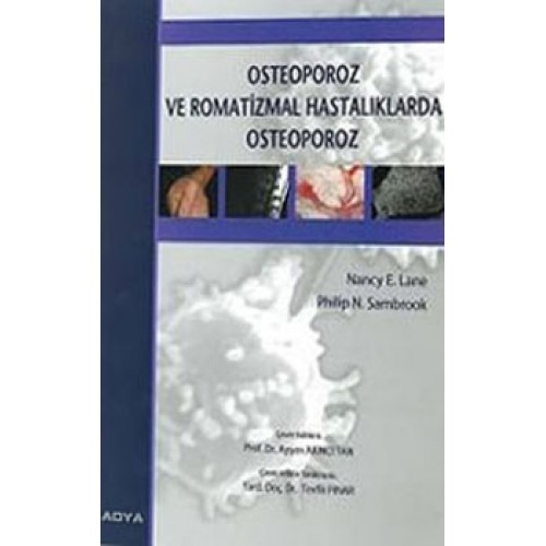 Osteoporoz ve Romatizmal Hastalıklarda Osteoporoz