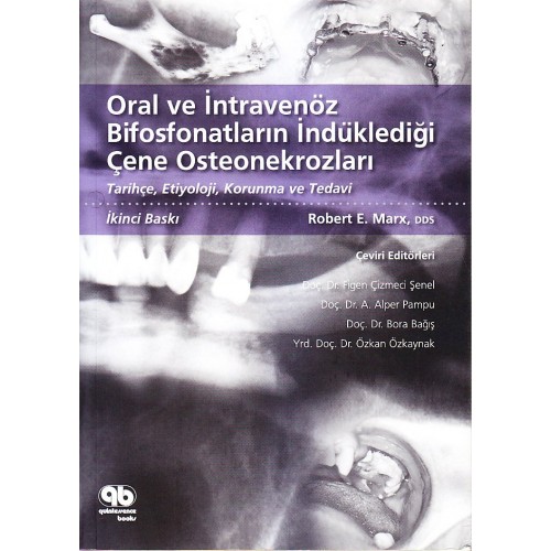 Oral ve İntravenöz Bifosfonatların İndüklediği Çene Osteonekrozları
