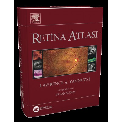 Yannuzzi Retina Atlası