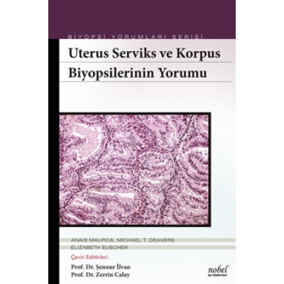 Uterus Serviks ve Korpus Biyopsilerinin Yorumu - Biyopsi Yorumları Serisi