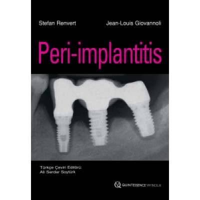Peri-implantitis , Stefan Renvert