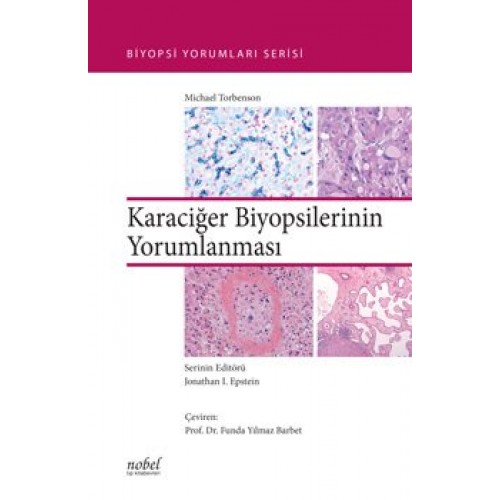 Karaciğer Biyopsilerinin Yorumlanması Biyopsi Yorumları Serisi