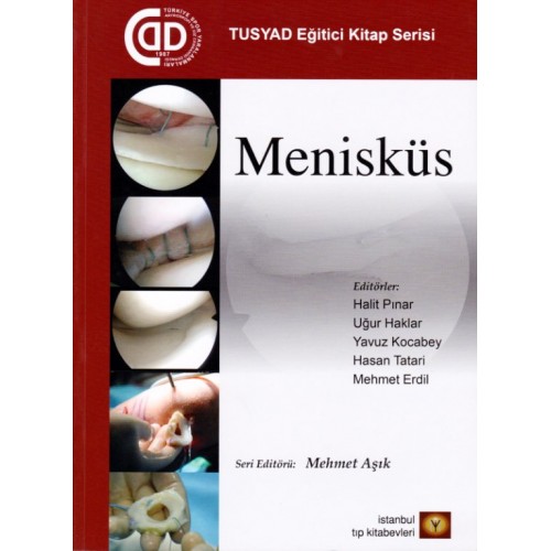 Menisküs