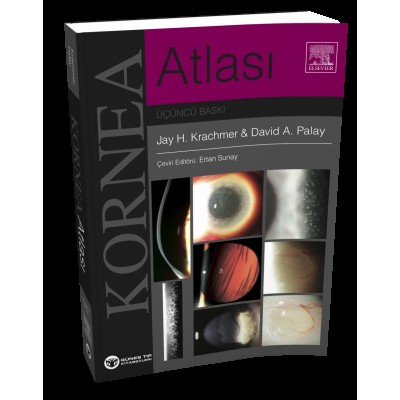 Krachmer Kornea Atlası