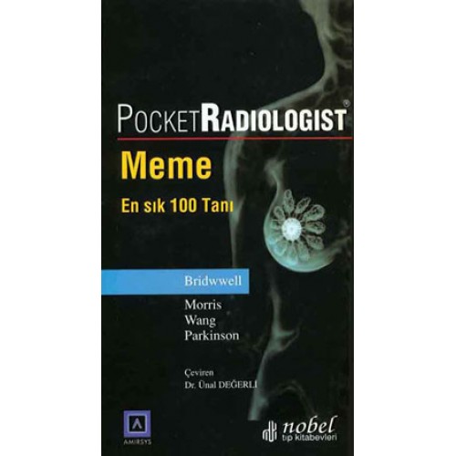 Pocket Radiologist: Meme - En Sık 100 Tanı