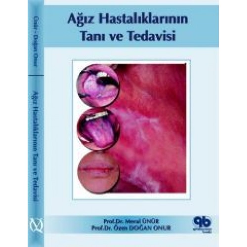 Ağız Hastalıklarının Teşhis ve Tedavisi Ağız Hastalıklarının Teşhis ve Tedavisi