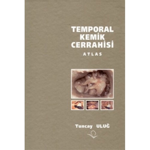 Temporal Kemik Cerrahisi Temporal Kemik Cerrahisi