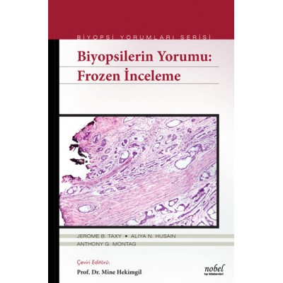 Biyopsilerin Yorumu: Frozen İnceleme - Biyopsi Yorumları Serisi