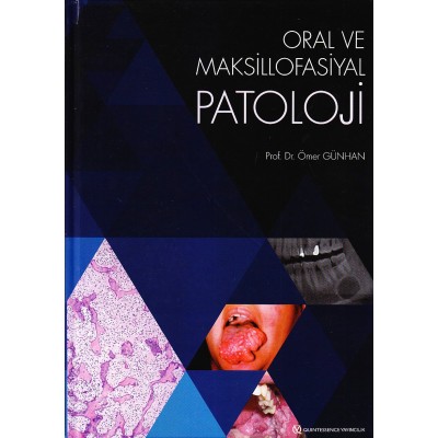Oral ve Maksillofasiyal Patoloji