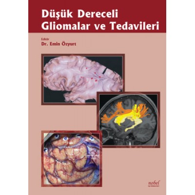 Düşük Dereceli Gliomalar ve Tedavileri Düşük Dereceli Gliomalar ve Tedavileri