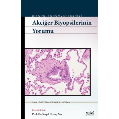 Akciğer Biyopsilerinin Yorumu - Biyopsi Yorumları Serisi