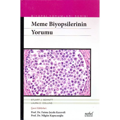 Meme Biyopsilerinin Yorumu