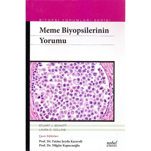 Meme Biyopsilerinin Yorumu