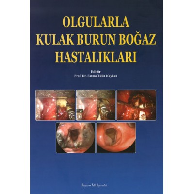 Olgularla Kulak Burun Boğaz Hastalıkları Olgularla Kulak Burun Boğaz Hastalıkları