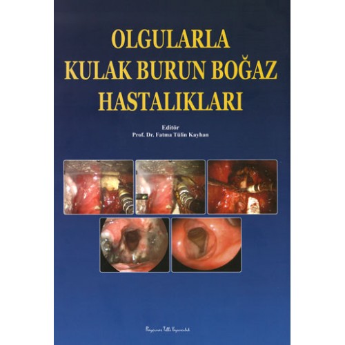 Olgularla Kulak Burun Boğaz Hastalıkları Olgularla Kulak Burun Boğaz Hastalıkları