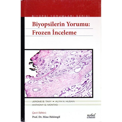 Biyopsilerin Yorumu: Frozen İnceleme