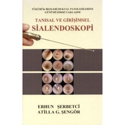 Tanısal ve Girişimsel Sialendoskopi Tanısal ve Girişimsel Sialendoskopi