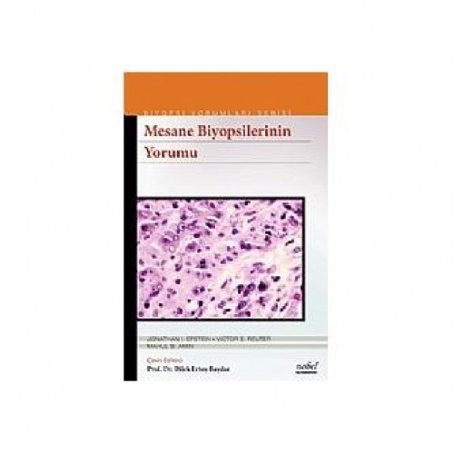 Mesane Biyopsilerinin Yorumu Biyopsi Yorumları Serisi