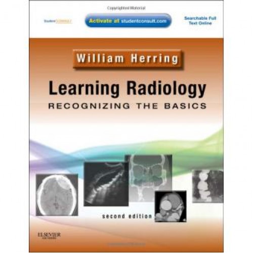 Learning Radiology: Recognizing the Basics