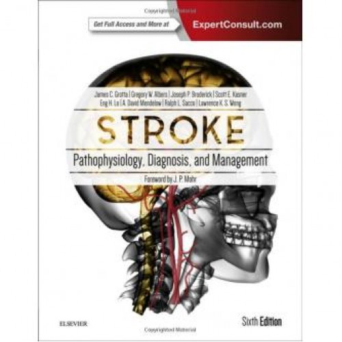 Stroke: Pathophysiology, Diagnosis, and Management