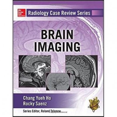 Radiology Case Review Series Brain Imaging