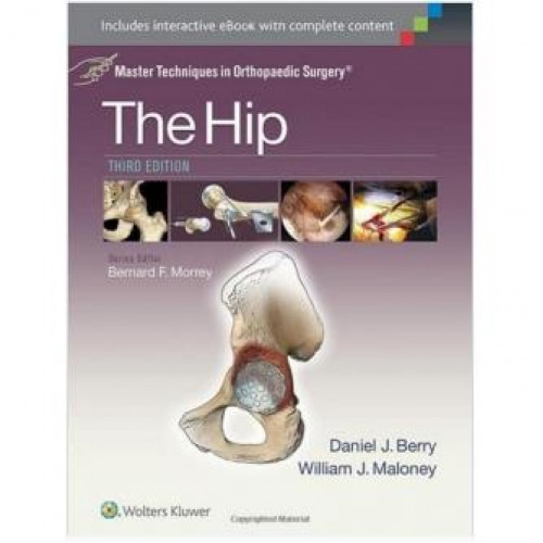 The Hip Master Techniques in Orthopaedic Surgery: Third Edition