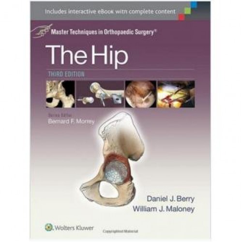 The Hip Master Techniques in Orthopaedic Surgery: Third Edition The Hip Master Techniques in Orthopaedic Surgery: Third Edition