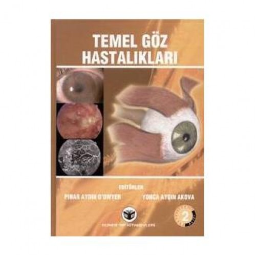 Temel Göz Hastalıkları