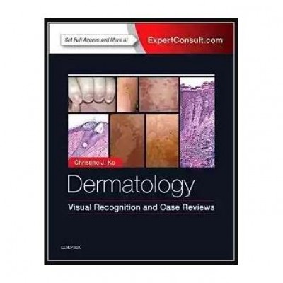 Dermatology: Visual Recognition and Case Reviews