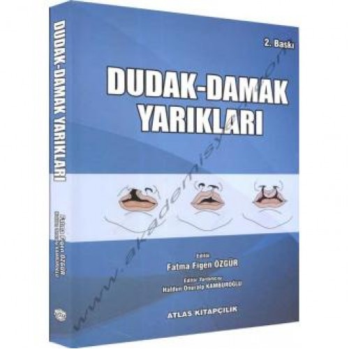 Dudak Damak Yarıkları