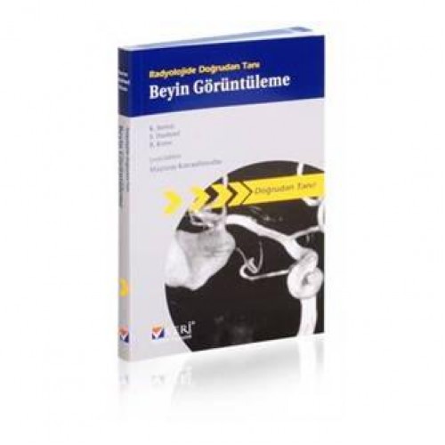 Radyolojide Doğrudan Tanı Beyin Görüntüleme