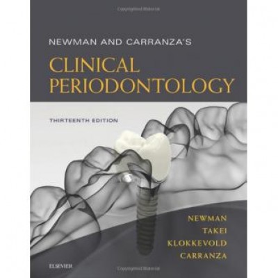 Newman and Carranza's Clinical Periodontology 13th ed. Edition