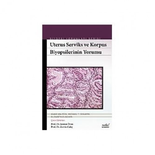 Uterus Serviks ve Korpus Biyopsilerinin Yorumu Biyopsi Yorumları Serisi