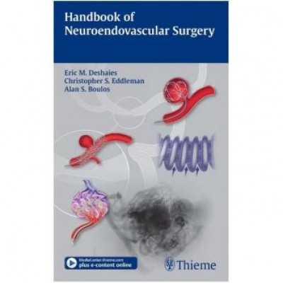 Handbook of Neuroendovascular Surgery 1st Edition