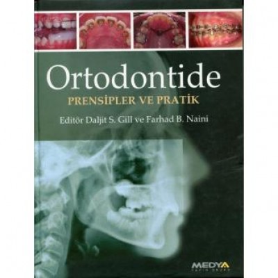 Ortodontide Prensipler ve Pratikler