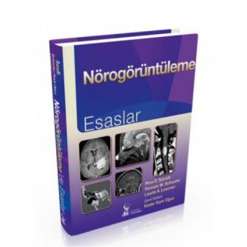 Nörogörüntüleme esasları