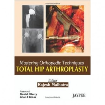 Total Hip Arthroplasty (Mastering Orthopedic Techniques)