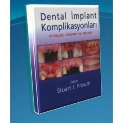 Dental İmplant Komplikasyonları
